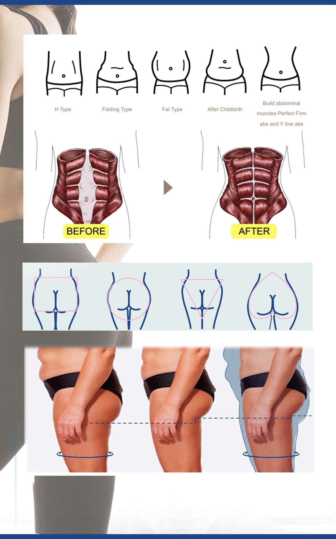 km-ems-before-after km-ems-before-after